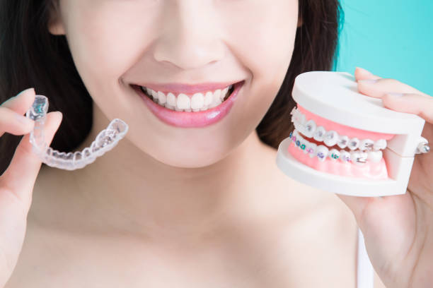 invisalign singapore